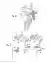 Fig. 12 - Equipment for inserting a joint prosthesis, in particular a knee prosthesis