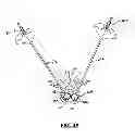 Fig. 06 - Method for balloon-aided vertebral augmentation