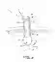 Fig. 04 - Surgical retrieval apparatus