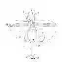 Fig. 05 - Surgical retrieval apparatus