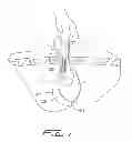 Fig. 08 - Surgical retrieval apparatus