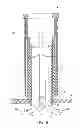 Fig. 08 - Suture delivery device