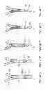 Fig. 35 - Suture delivery device