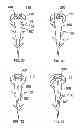 Fig. 06 - WOUND HEALING SYSTEM