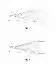 Fig. 03 - DILATION DEVICE