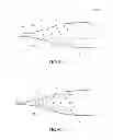 Fig. 04 - DILATION DEVICE