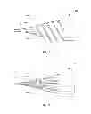 Fig. 05 - DILATION DEVICE