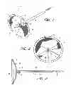 Fig. 02 - DEVICE FOR LEFT ATRIAL APPENDAGE OCCLUSION