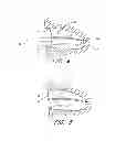 Fig. 04 - DEVICE FOR LEFT ATRIAL APPENDAGE OCCLUSION