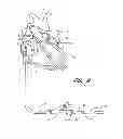Fig. 06 - DEVICE FOR LEFT ATRIAL APPENDAGE OCCLUSION