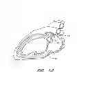 Fig. 07 - DEVICE FOR LEFT ATRIAL APPENDAGE OCCLUSION