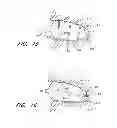 Fig. 10 - DEVICE FOR LEFT ATRIAL APPENDAGE OCCLUSION