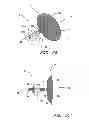 Fig. 16 - DEVICE FOR LEFT ATRIAL APPENDAGE OCCLUSION