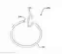 Fig. 01 - Devices and methods for securing medical devices within an anatomy