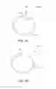Fig. 02 - Devices and methods for securing medical devices within an anatomy