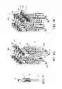 Fig. 08 - Systems, assemblies and methods for spinal derotation