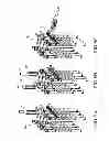 Fig. 09 - Systems, assemblies and methods for spinal derotation