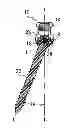 Fig. 01 - Staged locking of surgical screw assembly