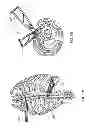 Fig. 22 - Staged locking of surgical screw assembly