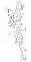 Fig. 10 - Occipito-cervical fixation assembly and method for constructing same