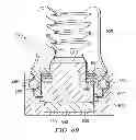 Fig. 12 - Occipito-cervical fixation assembly and method for constructing same