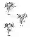 Fig. 02 - Locking confirmation mechanism for a bone screw and plate assembly