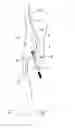 Fig. 07 - Minimal incision removable bone screw, driver, and method of use