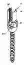 Fig. 01 - Locking force augmentation features for surgical screw assembly