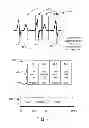 Fig. 06 - Methods and devices for accurately classifying cardiac activity