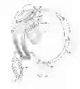 Fig. 06 - Visual prosthesis with integrated visor and video processing unit