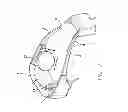 Fig. 08 - Visual prosthesis with integrated visor and video processing unit