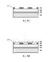 Fig. 03 - RETINAL PROSTHESIS