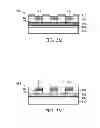 Fig. 22 - RETINAL PROSTHESIS