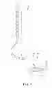 Fig. 02 - Lead with braided reinforcement