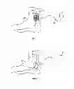 Fig. 02 - Method and apparatus for transdermal stimulation over the palmar and plantar surfaces