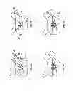 Fig. 06 - Method and apparatus for transdermal stimulation over the palmar and plantar surfaces