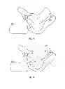 Fig. 09 - Method and apparatus for transdermal stimulation over the palmar and plantar surfaces