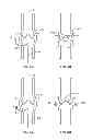 Fig. 07 - Methods, devices and systems for treating venous insufficiency