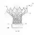 Fig. 22 - Heart valve prosthesis