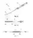 Fig. 02 - Stent delivery systems and associated methods