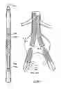Fig. 28 - Stent delivery systems and associated methods