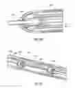 Fig. 09 - STENT DELIVERY SYSTEMS AND ASSOCIATED METHODS