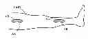 Fig. 01 - External support for elongated bodily vessels