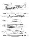 Fig. 02 - External support for elongated bodily vessels