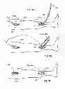 Fig. 09 - External support for elongated bodily vessels