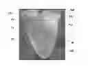 Fig. 01 - IMPLANTABLE PROSTHETIC VALVES AND METHODS