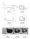 Fig. 02 - IMPLANTABLE PROSTHETIC VALVES AND METHODS