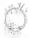 Fig. 02 - Ocular collar stent for treating narrowing of the irideocorneal angle