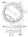 Fig. 05 - Ocular collar stent for treating narrowing of the irideocorneal angle