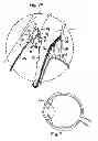 Fig. 08 - Ocular collar stent for treating narrowing of the irideocorneal angle
